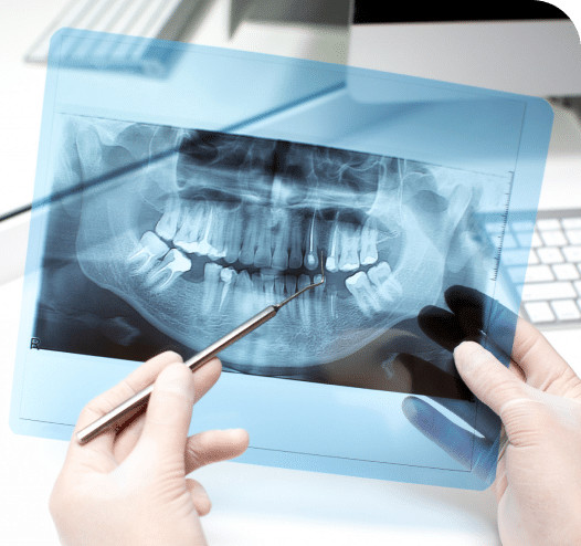 Digital X-Rays​ Peterborough