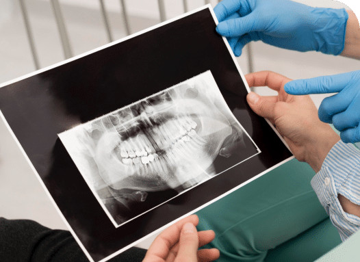 Type of Dental Digital X-Rays​