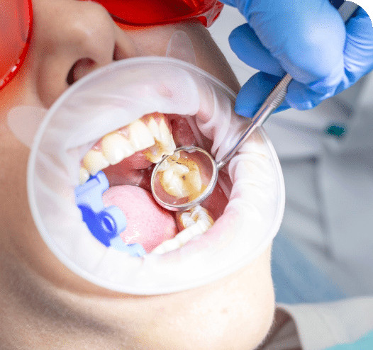 Dental Home Care Instructions​